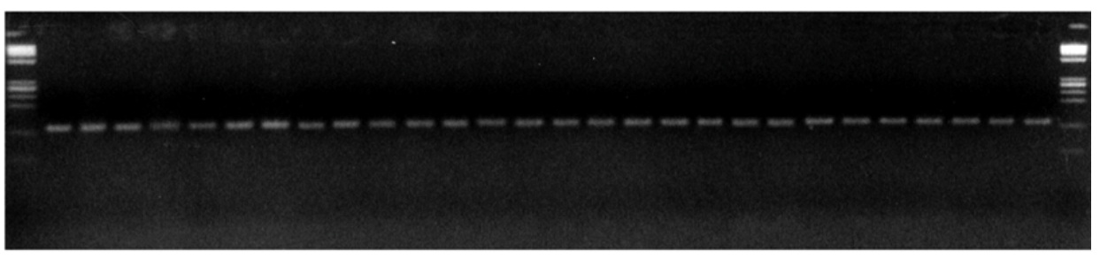 **Figure 1**: Banding pattern for a microsatellite locus (locus A) in a Brazilian popu-lation of a rice-infecting fungus. Brondani et al. (2000).