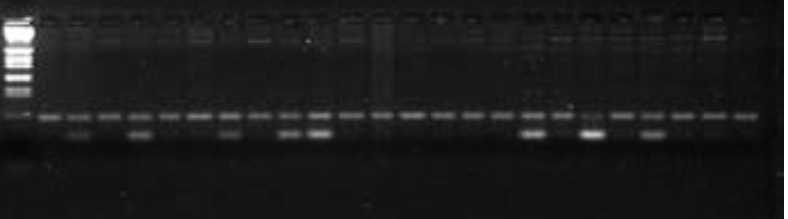 **Figure 2**: Banding pattern for a polymorphic microsatellite locus (locus B). Bron-dani et al. (2000).